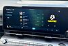 Hyundai KONA 1.6T 138 Advance 5dr Ecotronic Grey